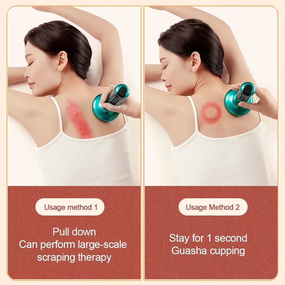 Electric Cupping Massager – Heating Vacuum Therapy & Fat Burner | Body Relaxation