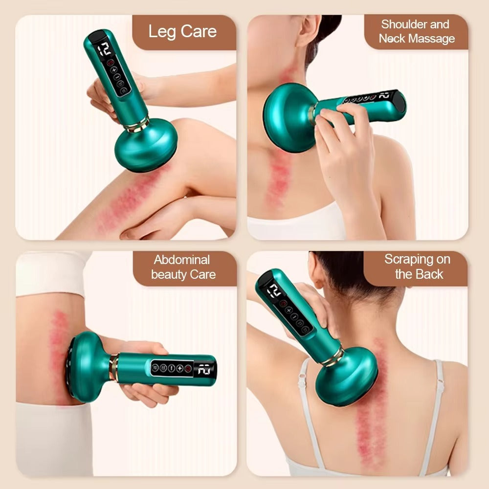 Electric Cupping Massager – Heating Vacuum Therapy & Fat Burner | Body Relaxation